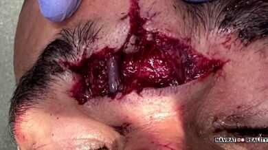 Rodrigues vs. Njokuanim