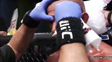 Rodrigues vs. Njokuanim