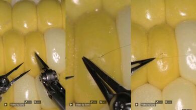 Sony představila nový chirurgický robot