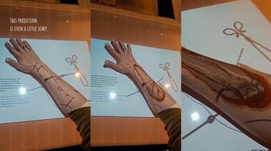 Chirurgická operace pomocí projektoru