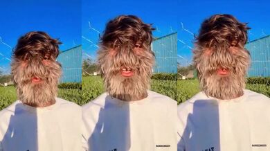 Nejchlupatější obličej na světě: Rekord drží indický teenager