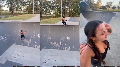 Pád na kolečkových bruslích skončil velkou boulí