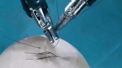 Robotičtí chirurgové dosahují nevídané přesnosti: operace vejce bez prasknutí skořápky