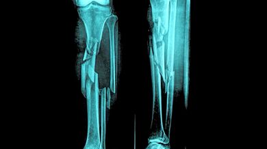 Zimní blbnutí na sněhu je tady!