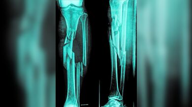 Zimní blbnutí na sněhu je tady!