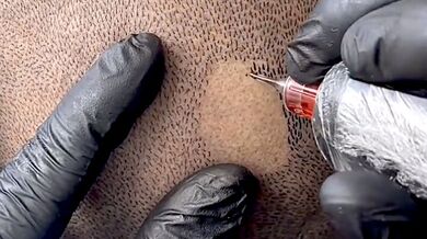 Mikropigmentace pokožky hlavy: Alternativa k transplantaci vlasů