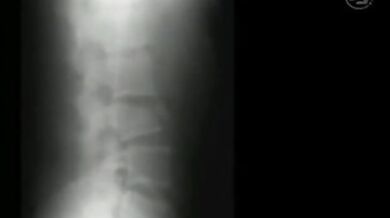 Nehoda Kennyho Bräcka z roku 2003