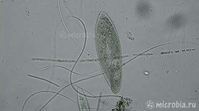 Útok na jednobuněčný organismus