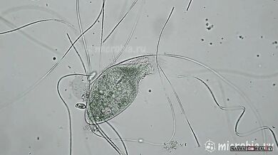 Útok na jednobuněčný organismus