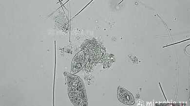 Útok na jednobuněčný organismus