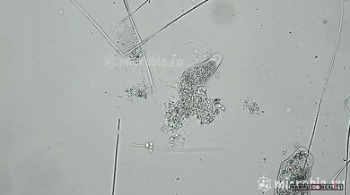 Útok na jednobuněčný organismus